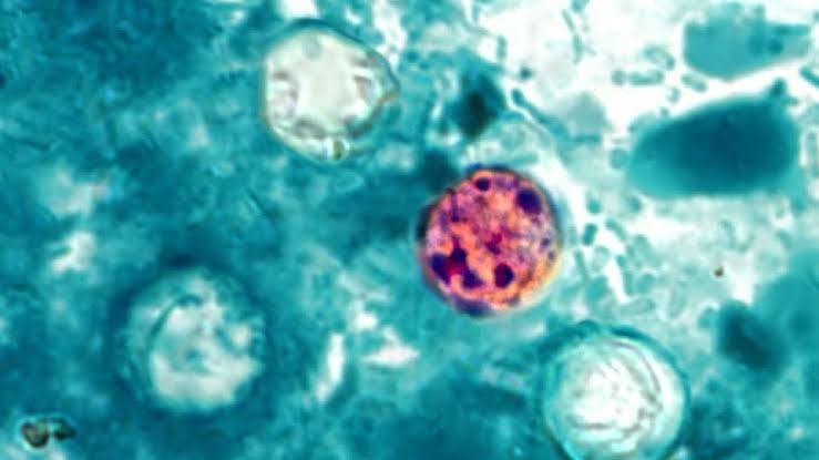 Microscopic view of Cyclospora cayetanensis oocysts in a stool sample stained for diagnostic testing.