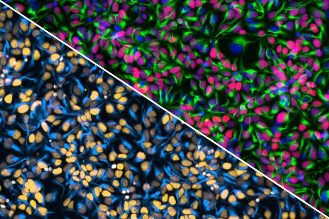 Dr. Michael F. Wells and research team working with neural progenitor cell cultures in a laboratory setting at UCLA.