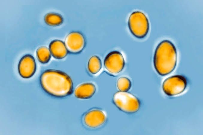 A magnified, colorized laboratory view of the yeast-like fungus Candida auris.