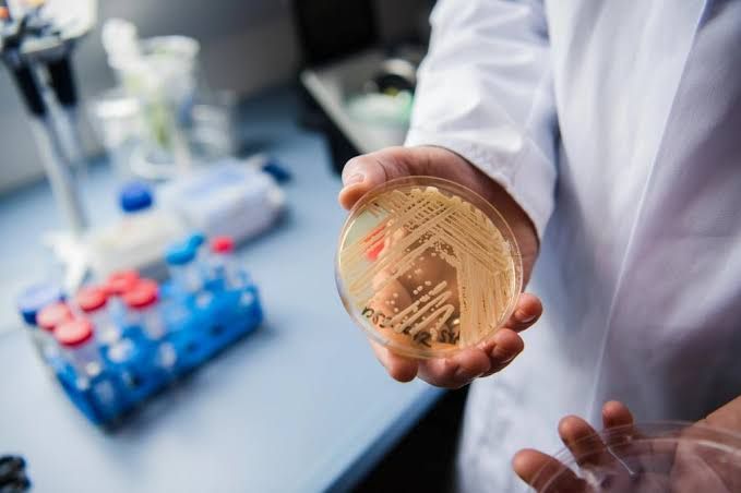 A scientist holding a petri dish in a laboratory setting to test for the spread of the Candida auris fungus.