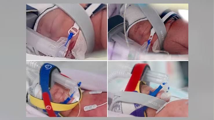 Four newborn baby girls lying in hospital bassinets at Royal Brisbane and Women's Hospital.