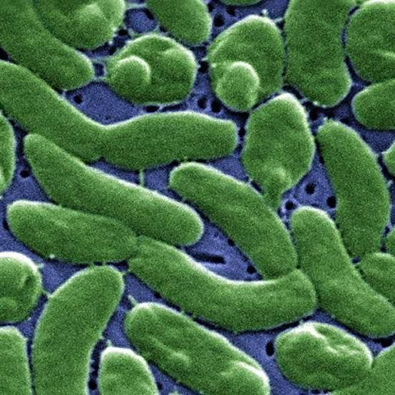A clinical warning sign about Vibrio bacteria risks in coastal waters provided by the CDC.